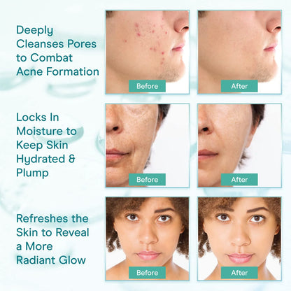 Collagen Cleansing Milk for Face, Vegan Facial Cleanser for Women and Men, Micellar Makeup Remover, Milk Cleanser Face Wash 8 Fl Oz